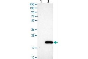 Western blot analysis of Lane 1: Negative control (vector only transfected HEK293T lysate), Lane 2: Over-expression Lysate (Co-expressed with a C-terminal myc-DDK tag (~3. (C11orf1 抗体)