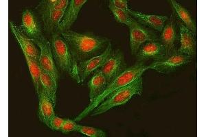 IF analysis of RFX3 using anti-RFX3 antibody (ABIN7601095) and anti-Tubulin Alpha antibody (ABIN7600339).