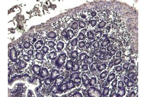 (ABIN184983) Negative Control showing staining of paraffin embedded Human Colon, with no primary antibody. (TRIM5 抗体  (N-Term))