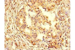 Immunohistochemistry (IHC) image for anti-Proliferating Cell Nuclear Antigen (PCNA) (AA 1-261) antibody (ABIN7164738)