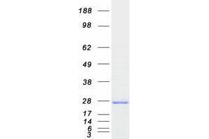Western Blotting (WB) image for Casein Kinase 2, beta (CSNK2B) protein (Myc-DYKDDDDK Tag) (ABIN2713196)