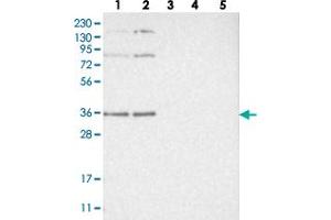 Western blot analysis of Lane 1: RT-4, Lane 2: U-251 MG, Lane 3: Human Plasma, Lane 4: Liver, Lane 5: Tonsil with WRNIP1 polyclonal antibody  at 1:250-1:500 dilution. (WRNIP1 抗体)
