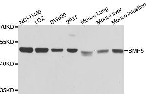Western blot analysis of extracts of various cell lines, using BMP5 antibody. (BMP5 抗体)