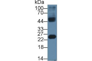 Western Blot; Sample: Mouse Testis lysate; Primary Ab: 1µg/ml Rabbit Anti-Human HMGB4 Antibody Second Ab: 0. (HMGB4 抗体  (AA 25-167))