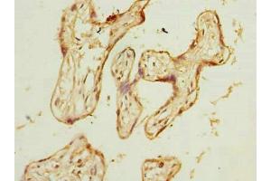 Immunohistochemistry of paraffin-embedded human placenta tissue using ABIN7175802 at dilution of 1:100 (WDR89 抗体  (AA 1-387))