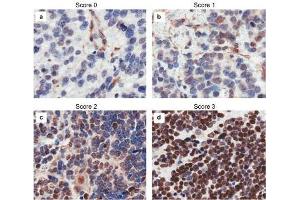 Immunohistochemistry (IHC) image for anti-Castor Zinc Finger 1 (CASZ1) (Internal Region) antibody (ABIN964598)