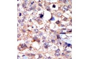 Image no. 2 for anti-C-Abl Oncogene 1, Non-Receptor tyrosine Kinase (ABL1) (C-Term) antibody (ABIN359966) (ABL1 抗体  (C-Term))
