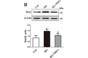 MSCs attenuate HG-induced mitochondrial dysfunction. (beta Actin 抗体  (AA 1-375))