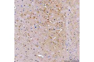 IHC analysis of SRGAP3 using anti-SRGAP3 antibody (ABIN7602538).