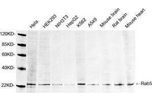 Western blot analysis of lysates using 1 µg/mL Rabbit Anti-Rab5 Polyclonal Antibody (ABIN398815) The signal was developed with IRDyeTM 800 Conjugated Goat Anti-Rabbit IgG. (RAB5 抗体  (AA 150-200))