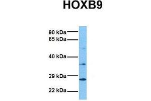 Western Blotting (WB) image for anti-Homeobox B9 (HOXB9) (N-Term) antibody (ABIN2779768)