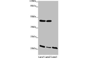 Western blot All lanes: ZDHHC16 antibody at 1. (ZDHHC16 抗体  (AA 288-377))