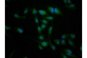 Immunofluorescence staining of Hela cells with ABIN7149425 at 1:266, counter-stained with DAPI. (NT5C2 抗体  (AA 487-553))