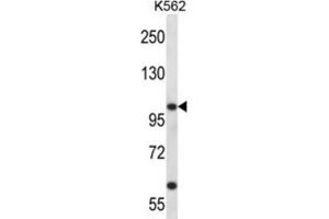 Western Blotting (WB) image for anti-Potassium Voltage-Gated Channel, Shaw-Related Subfamily, Member 3 (KCNC3) antibody (ABIN2998065) (KCNC3 抗体)
