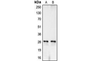 Western blot analysis of Carbonic Anhydrase 1 expression in TF1 (A), K562 (B) whole cell lysates. (CA1 抗体  (Center))