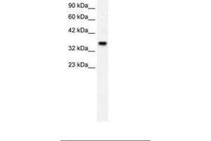 Image no. 2 for anti-Forkhead Box F1 (FOXF1) (AA 292-341) antibody (ABIN202327) (FOXF1 抗体  (AA 292-341))