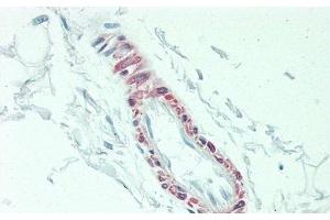Detection of IL3 in Human Skeletal Muscle Tissue using Polyclonal Antibody to Interleukin 3 (IL3) (IL-3 抗体  (AA 20-152))