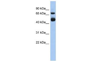 WB Suggested Anti-ALOX15 Antibody Titration: 0. (ALOX15 抗体  (Middle Region))