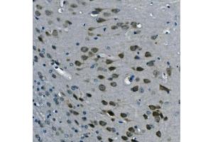 IHC analysis of PCBP2/hnRNP E2 using anti-PCBP2/hnRNP E2 antibody (ABIN7600449). (PCBP2 抗体  (AA 197-276))