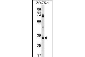 PDCD1LG2 Antibody (N-term) (ABIN656243 and ABIN2845559) western blot analysis in ZR-75-1 cell line lysates (35 μg/lane). (PDCD1LG2 抗体  (N-Term))