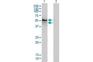 Western Blotting (WB) image for anti-Homocysteine-Inducible, Endoplasmic Reticulum Stress-Inducible, Ubiquitin-Like Domain Member 1 (HERPUD1) (AA 1-391) antibody (ABIN564200)
