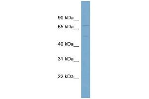 WB Suggested Anti-SLC7A1  Antibody Titration: 0. (SLC7A1 抗体  (N-Term))