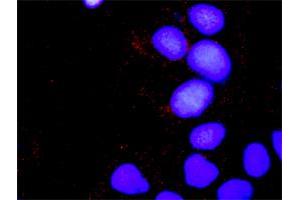 Proximity Ligation Analysis of protein-protein interactions between CRKL and SOS1. (CrkL 抗体  (AA 1-303))