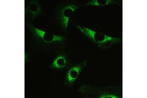Immunohistochemistry (IHC) image for anti-Myosin Phosphatase, Target Subunit 1 (PPP1R12A) (AA 1-40), (N-Term) antibody (ABIN3043902)