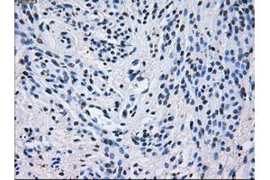 Immunohistochemical staining of paraffin-embedded liver tissue using anti-PSMA7mouse monoclonal antibody. (PSMA7 抗体)