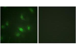 Immunofluorescence analysis of HepG2 cells, using STAT5A/B (Phospho-Ser725/730) Antibody. (STAT5 A/B 抗体  (pSer726))