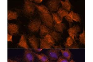 Immunofluorescence analysis of C6 cells using SCRN3 Polyclonal Antibody at dilution of 1:100. (Secernin 3 抗体)