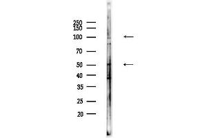 Western blot analysis of lysates from HepG2 cells(heat-shock,45 min treatment), using C Antibody at 1/1000 dilution.