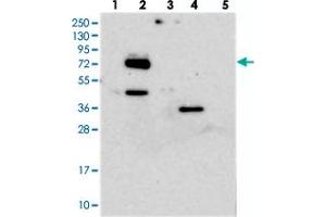 Western blot analysis of Lane 1: RT-4, Lane 2: U-251 MG, Lane 3: Human Plasma, Lane 4: Liver, Lane 5: Tonsil with EYA4 polyclonal antibody . (EYA4 抗体)