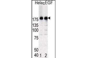Western blot analysis of EGFR (arrow) in Hela cell lysates, either induced (Lane 1) or noninduced with EGF (Lane 2). (EGFR 抗体  (pTyr1092))