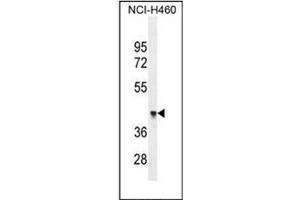 Western blot analysis of OXD4-like 1 Antibody (N-term) in NCI-H460 cell line lysates (35ug/lane). (FOXD4L1 抗体  (N-Term))