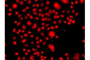 Immunofluorescence analysis of A549 cell using FANCM antibody. (FANCM 抗体)