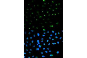 Immunofluorescence analysis of MCF7 cell using PSAP antibody. (Prosaposin 抗体  (AA 60-310))