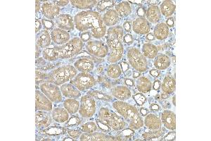 Immunohistochemistry of paraffin-embedded rat kidney using IL11RA Rabbit mAb (ABIN7267984) at dilution of 1:150 (40x lens). (IL11RA 抗体)
