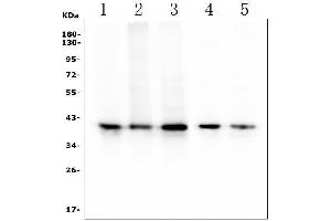 Western blot analysis of RP2 using anti ZO-1 antibody (ABIN7600869).