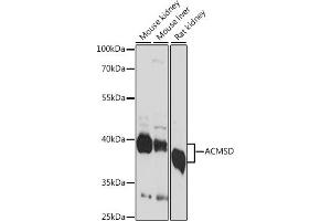 Western blot analysis of extracts of various cell lines, using ACMSD antibody (ABIN7265570) at 1:1000 dilution. (ACMSD 抗体  (AA 1-336))