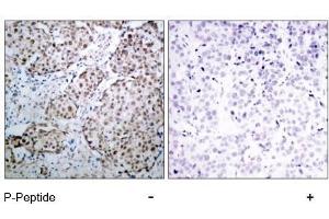 Image no. 3 for anti-Tumor Protein P53 (TP53) (pSer315) antibody (ABIN196788) (p53 抗体  (pSer315))
