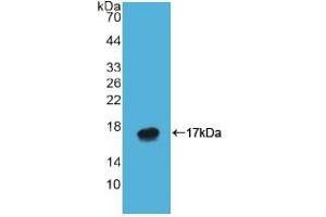 Detection of Recombinant ATP4a, Human using Polyclonal Antibody to ATPase, H+/K+ Exchanging Alpha Polypeptide (ATP4a)