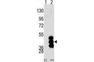 Western blot analysis of PHKG2 (arrow) using PHKG2 Antibody (N-term) .