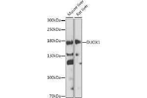 Western blot analysis of extracts of various cell lines, using DUOX1 antibody (ABIN6127816, ABIN6139857, ABIN6139858 and ABIN6224687) at 1:1000 dilution. (DUOX1 抗体  (AA 1312-1551))