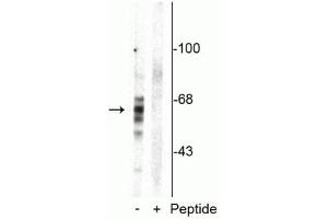 Western blot of rat brain homogenate showing specific immunolabeling of the ~59 kDa, ~65 kDa, ~68 kDa Tau isoforms phosphorylated at Ser416 in the first lane (-). (MAPT 抗体  (pSer416))