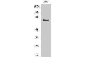 Western Blotting (WB) image for anti-Guanylate Cyclase 1 Soluble Subunit Alpha (GUCY1A1) (Internal Region) antibody (ABIN3175251) (GUCY1A1 抗体  (Internal Region))