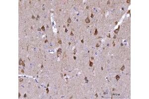 IHC analysis of Nedd4 using anti-Nedd4 antibody (ABIN7602341).