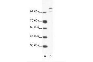 Image no. 1 for anti-HKR1, GLI-Kruppel Zinc Finger Family Member (HKR1) (AA 191-240) antibody (ABIN202856) (HKR1 抗体  (AA 191-240))