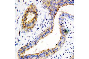 Immunohistochemistry (IHC) image for anti-Branched Chain Amino-Acid Transaminase 1, Cytosolic (BCAT1) (AA 360-375), (C-Term) antibody (ABIN3044434)
