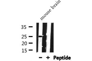 Western blot analysis of APOA1 expression in Mouse brain lysate (APOA1 抗体  (N-Term))